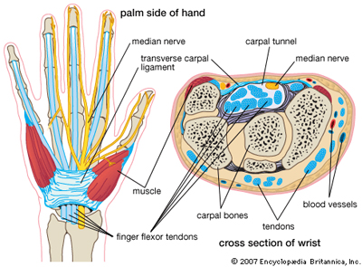 Carpal tunnel syndrome (CTS)