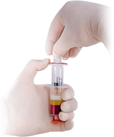 PRP Injection Treatment