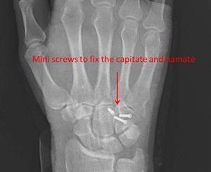 Unusual fracture dislocation